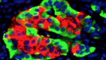 Researchers show that stem cells can beat back diabetes