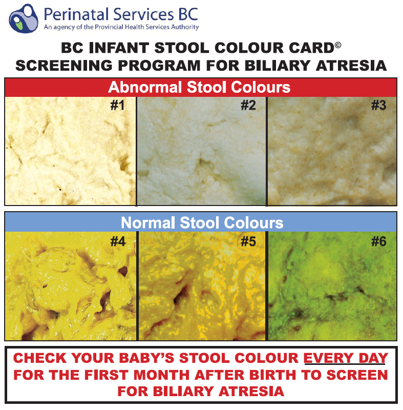 free 7 sample stool color chart templates in pdf - how to soften newborn stool newbornprotipscom beige stool in adults | jaundice stool color chart