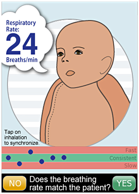 A faster way to measure a patient's breathing rate - UBC Faculty of ...