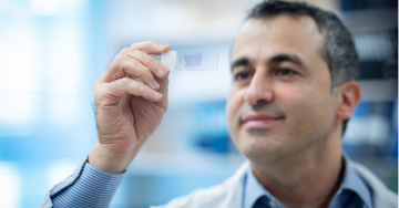 Dr. Ali Bashashati observes a microscope slide containing endometrial cancer cells.